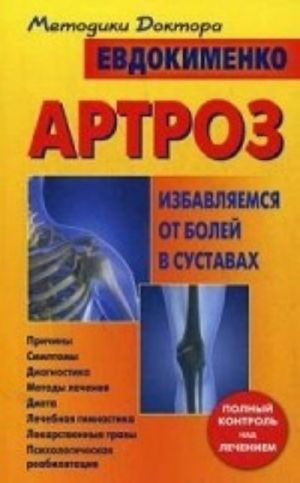 Артроз. Избавляемся от болей в суставах