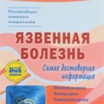 Язвенная болезнь