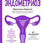 Эндометриоз. Как разобраться в причинах, распознать симптомы и позаботиться о себе в повседневной жизни